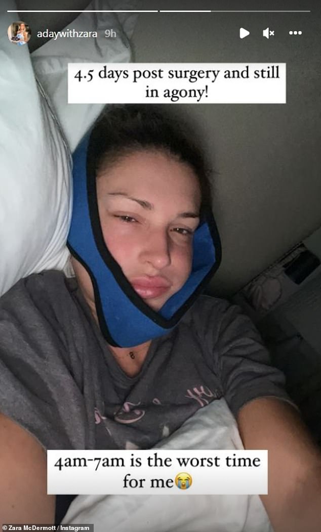 Painful: Zara recently took to Instagram to document the pain she was experiencing after having urgent surgery to remove her wisdom teeth