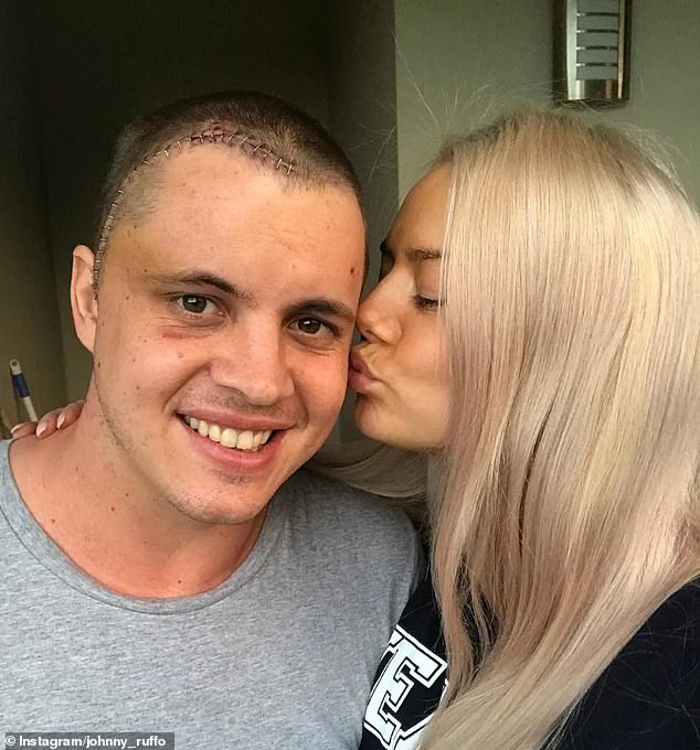 Johnny Ruffo recalls the day he was first told he had brain cancer