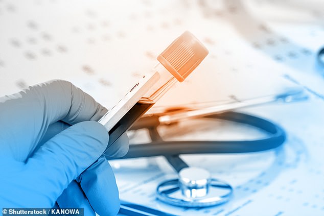 How a simple £15 hormone blood test administered by GPs could save thousands