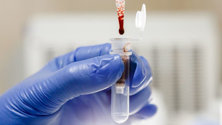 Lab-grown blood transfused to people in world-first clinical trial