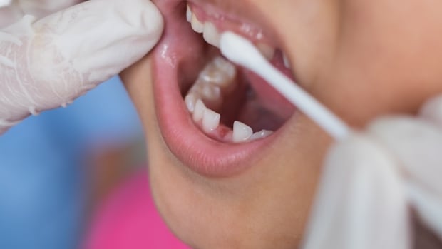 Federal dental benefit officially becomes law