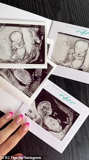 Tigerlily shared an Instagram reel that showed her positive pregnancy test and sonogram images