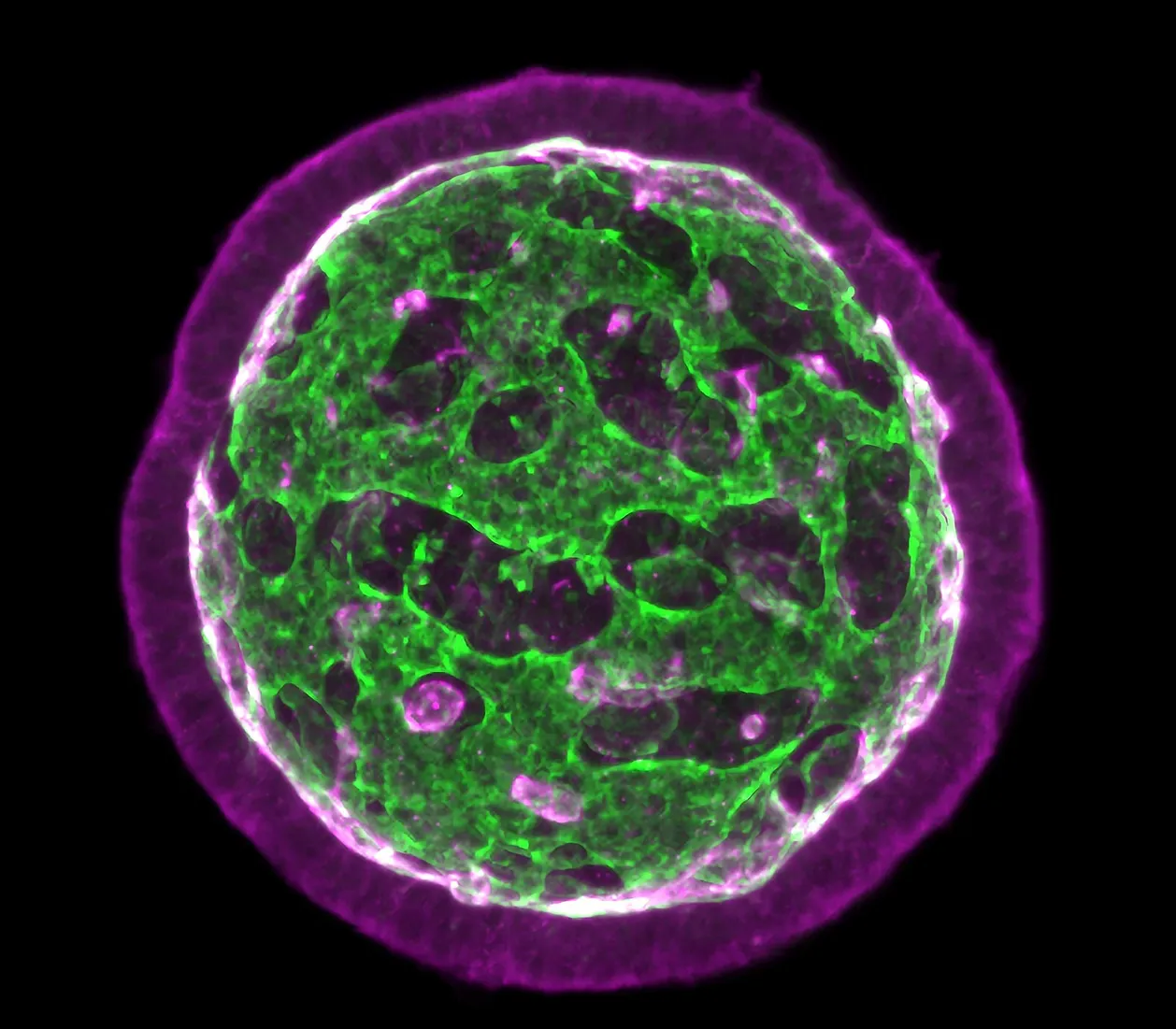 Neuroepithelial Organoids Architecture