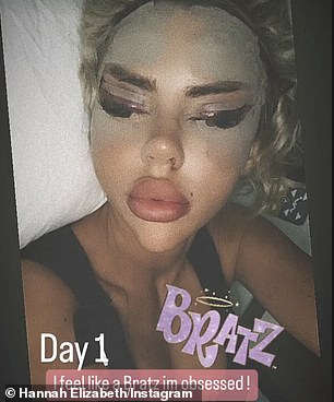 Love Island’s Hannah Elizabeth reveals the shocking results of her facial surgery