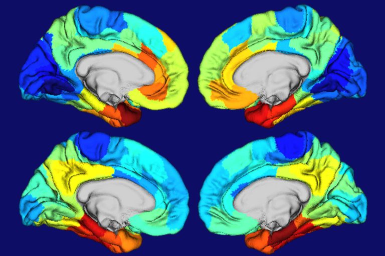 Why Alzheimer’s Disease Damages Certain Parts of the Brain – New Genetic Clues