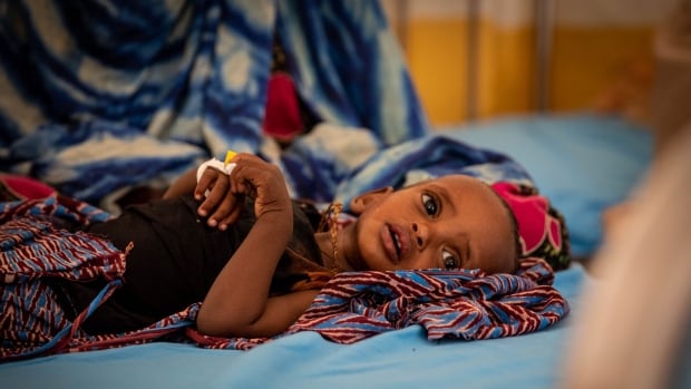 Somalia on the brink of another brutal famine, with children bearing the brunt