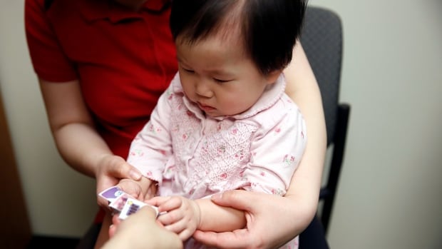 Measles an imminent global threat due to pandemic, CDC and WHO say