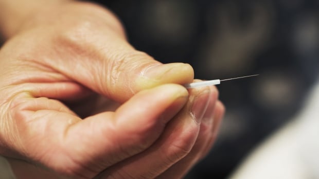 B.C. acupuncturist committed misconduct by doing blood-letting while banned, college says