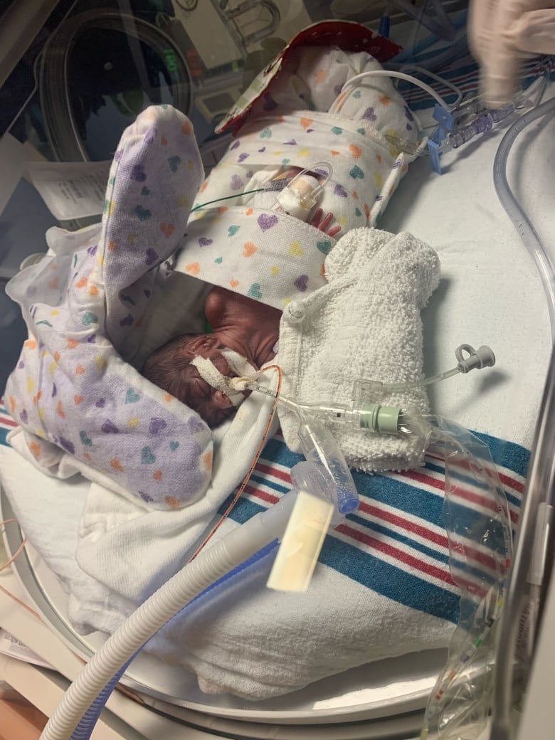 A very tiny infant with black hair is in an incubator surrounded by blankets and tubes. 