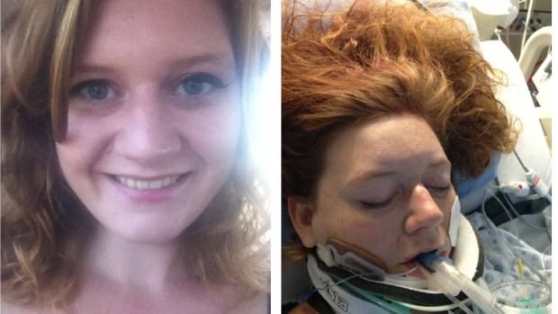 ‘I just live life in pain, it’s my price to be alive,’ says impaired driving victim years after being struck