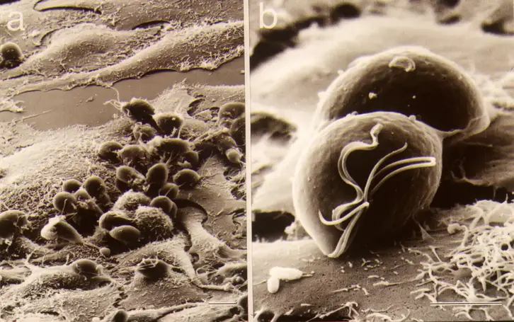 Ellipsoid Tvag on HeLa Cells