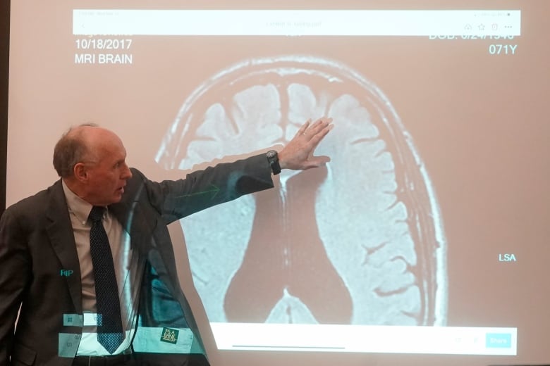 A man points at a projected image of a brain in a courtroom.