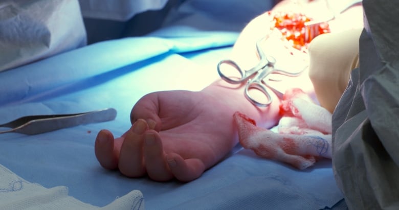 A hand and arm are shown in a close-up on a hospital bed during a surgery above the wrist. 