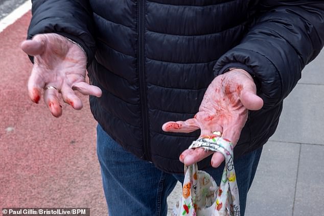 Dave Dawson, 76, was visiting the high street in Keynsham, Somerset, earlier today when he sustained injuries to his hands and knees as he stepped off the kerb's edge