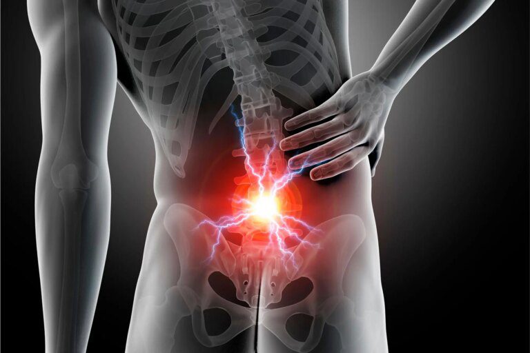 New Analysis Dispels Common Back Pain Myth and Reveals a Looming Crisis