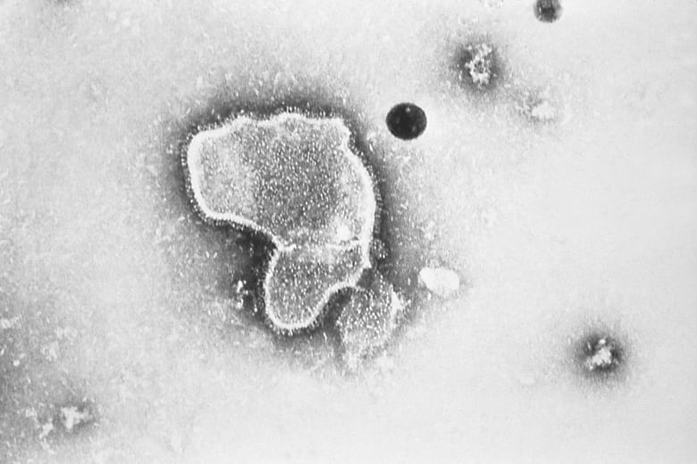 A picture of the respiratory syncytial virus taken via electron micrograph.