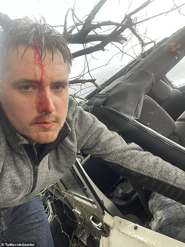 Journalist reveals horrific injuries after his truck was tossed off the road from enormous tornado