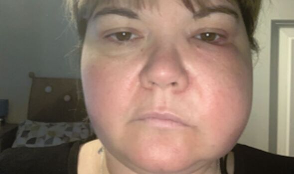 Woman awarded thousands after turning to ‘really unpleasant’ DIY dentistry