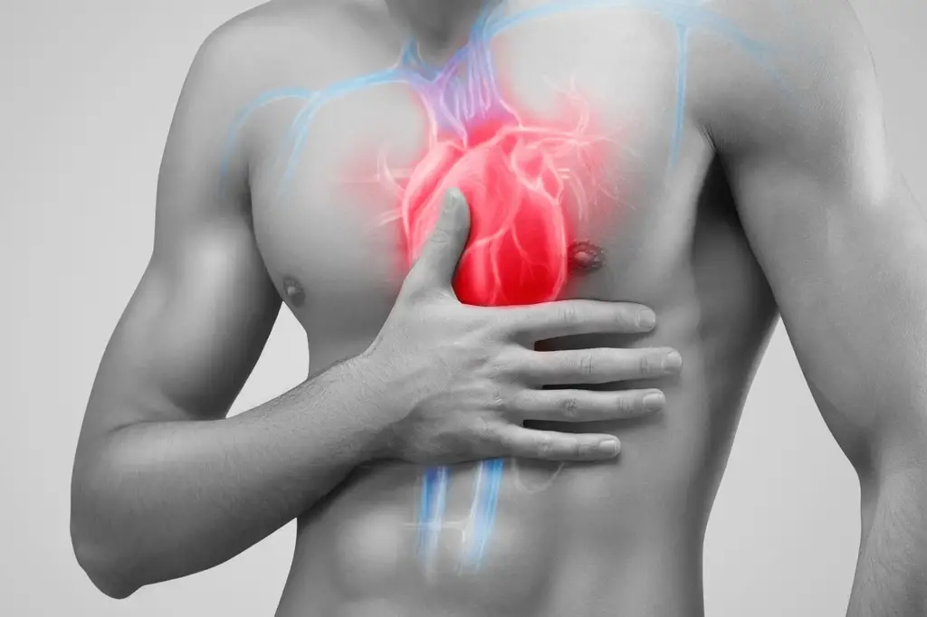 Myocarditis Young Man Heart Disease Concept