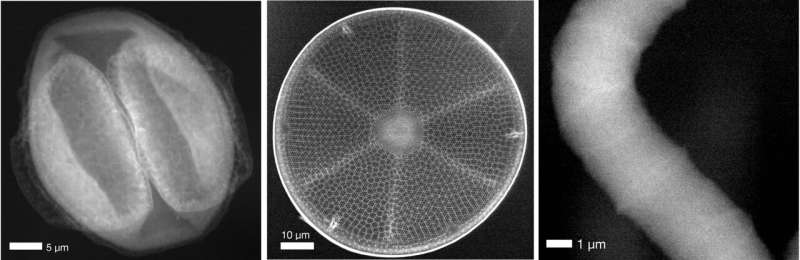 Biological specimens imaged with X-rays without damage