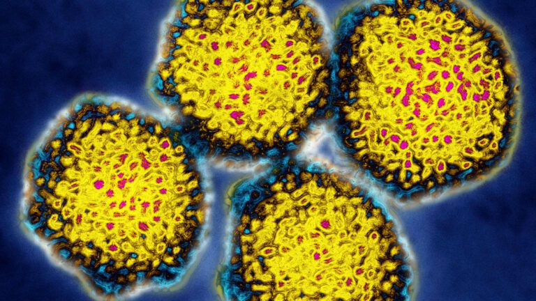 Hepatitis C cure isn’t reaching patients due to cost, CDC says