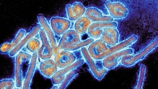 Ebola-like Marburg virus linked to 8 deaths in Rwanda