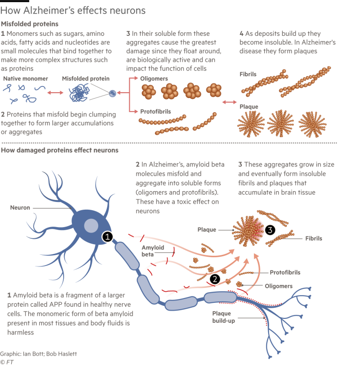 Illustration showing how Alzheimer’s effects neurons and the plaque build up causes damage