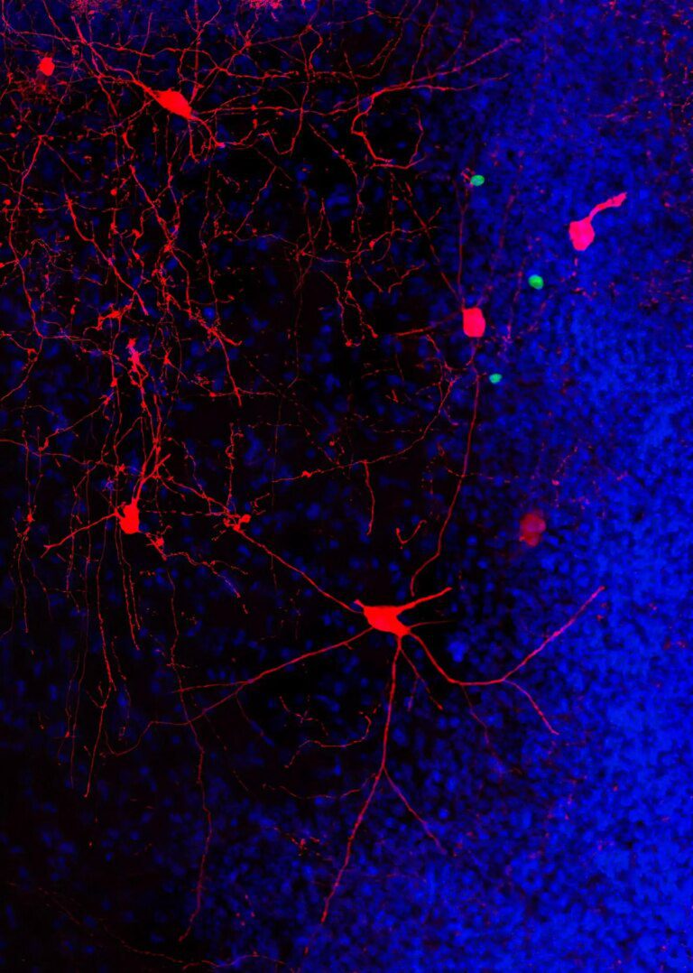 Middle-Aged Running Keeps “Old” Adult-Born Neurons “Wired”