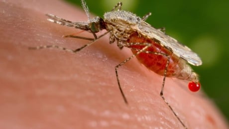 U.S. reports 1st ‘domestically acquired’ malaria cases in 20 years