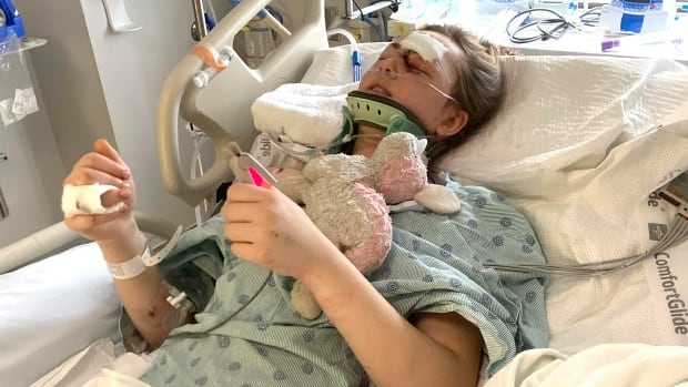 This teen almost died in a crash. Her mom says a special hospital team saved her