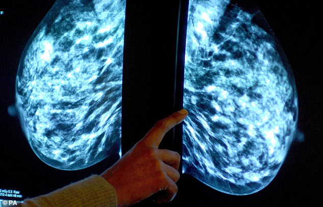 Now AI’s good enough to assess your mammogram: Study finds computer-trained programme spots 20% more cancers than human radiologists