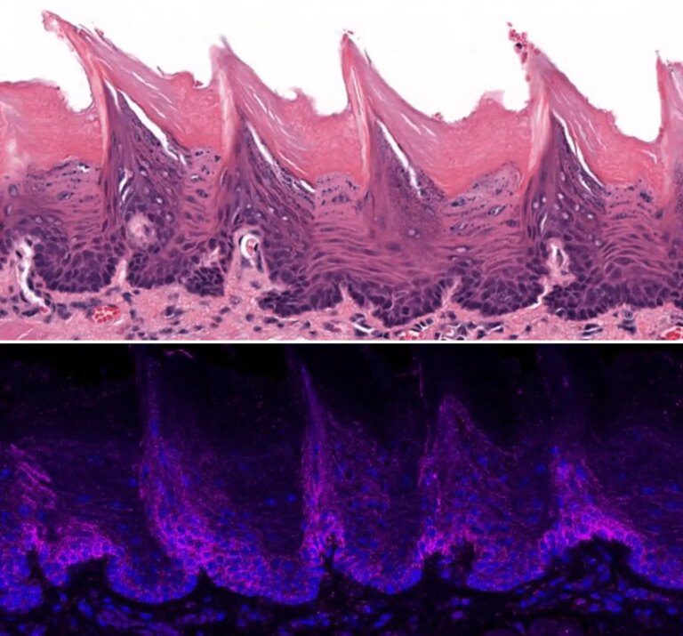 “Gates of Heaven” – The Protein Fueling Oral Cancer’s Pain and Progression