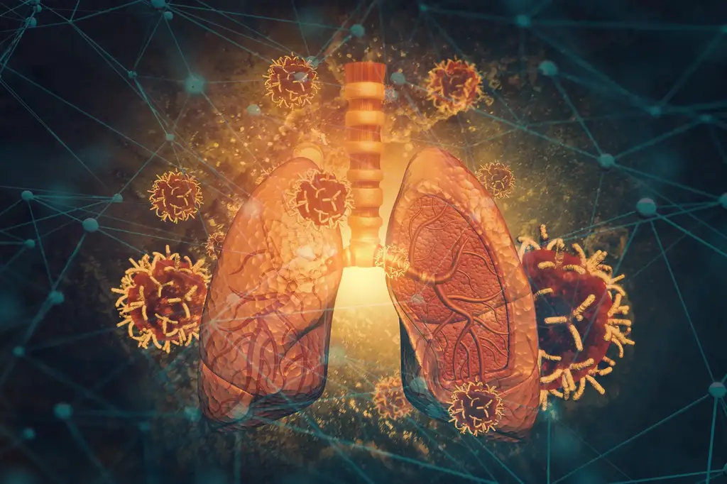 Lung Disease Atlas Concept