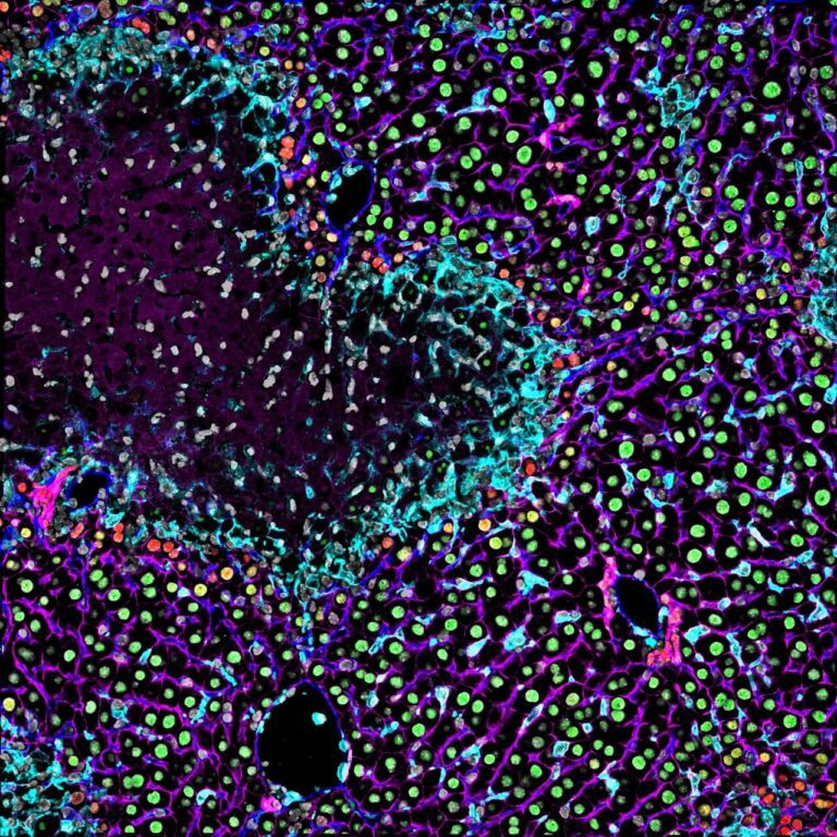 Monocyte-derived macrophages could be central to liver regeneration