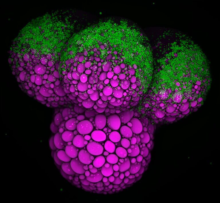 New research on fruit flies provides key insights into the nutrients essential for embryo development