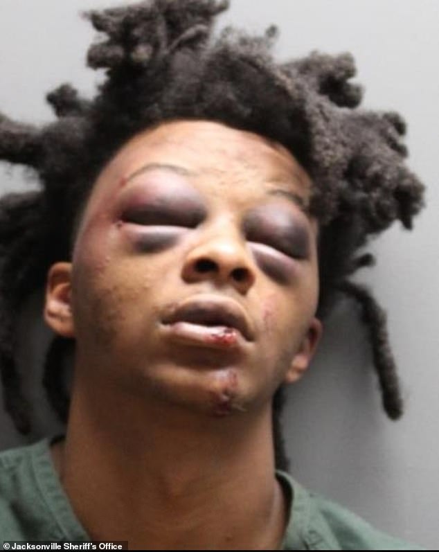 ‘I felt like Emmett Till’s mother when she saw her son’: Mom’s fury as son LeKeian Woods, 24, is left  ‘unrecognizable’ after three white Florida cops smashed his face into the sidewalk during a brutal arrest for ‘not wearing a seatbelt’