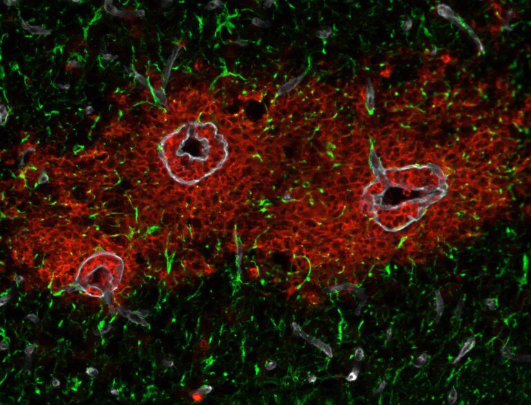 New Research Uncovers Blood-Brain Barrier Mystery