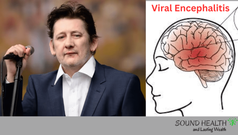 Singer Shane MacGowan Sickness Viral encephalitis: Know the Symptoms, Cause and Prevention 