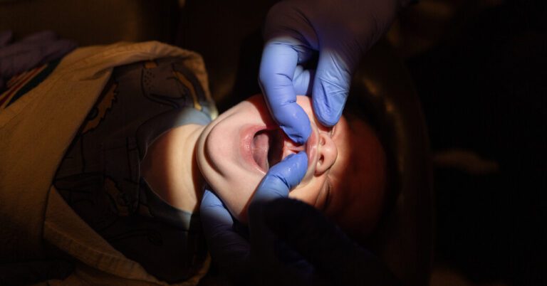 Tongue Tie Surgery: Inside the Business of Cutting Babies’ Tongues