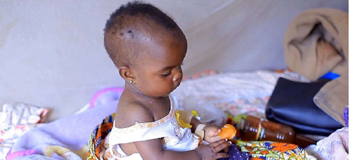 A child recovering from malaria at the Gracia Health Center in Beni town, in the Democratic Republic of the Congo's province of North Kivu