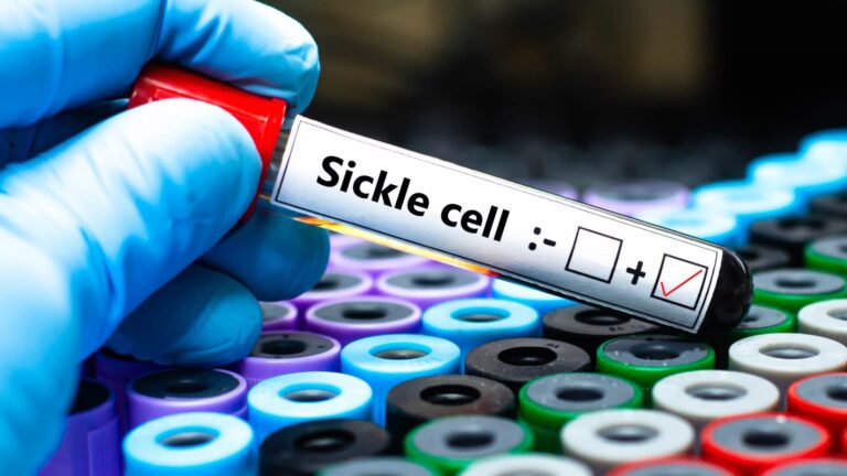 Sickle cell disease gene therapies Casgevy Lyfgenia insurance cost issues