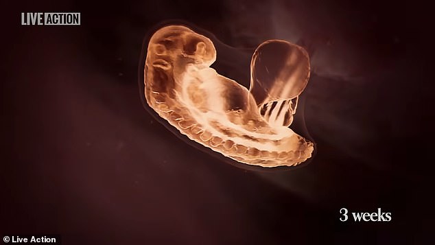 The clip claims the heart starts beating by three weeks. Doctors say the heart actually starts beating at six weeks — or four weeks after fertilization