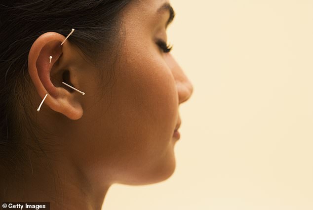 Could acupuncture stop the constant ringing in my ears? Ask the GP DR MARTIN SCURR