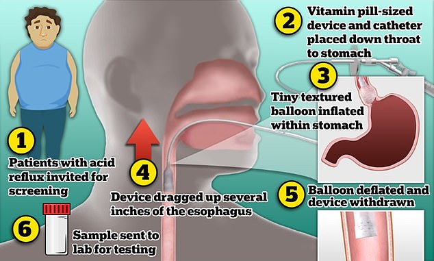 New experimental pill that spots tumors YEARS before they develop could prevent ‘death sentence’ form of cancer