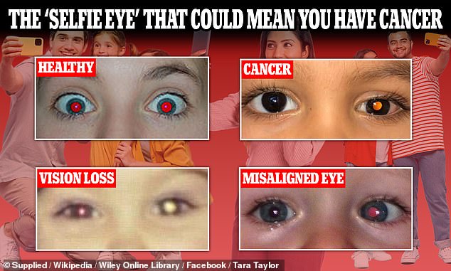 What having red eye in photos really means – and why it could be GOOD for your health