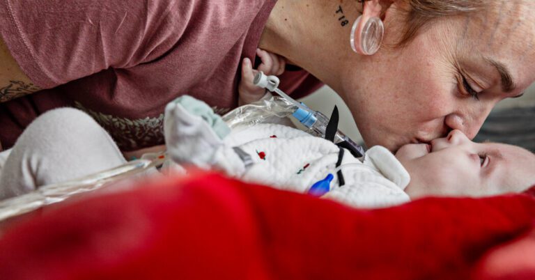 How 2 Families Faced a Catastrophic Birth Defect