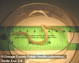 An adult female A. lumbricoides, as was found in the Mississippi toddler's diaper