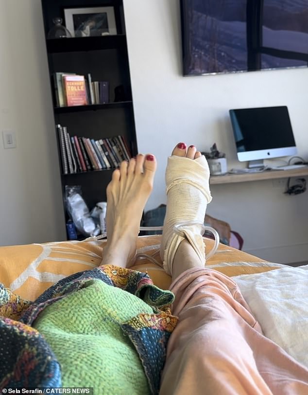 Ms Serafin's feet after her surgeries