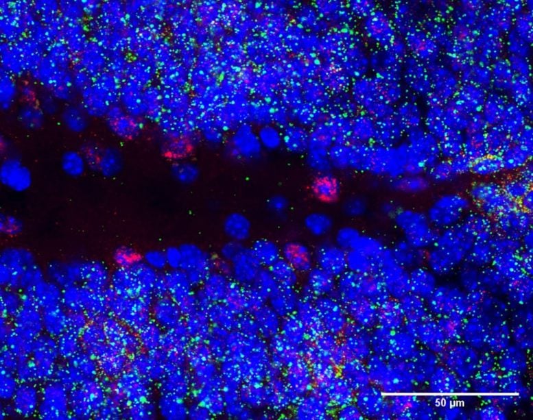 SNHG11 Expression in the Hippocampus