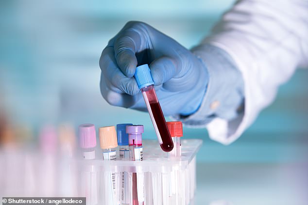 Alarm over forever chemicals as scientists find ‘clear’ proof the toxic chemicals lurking in our blood can harm the heart